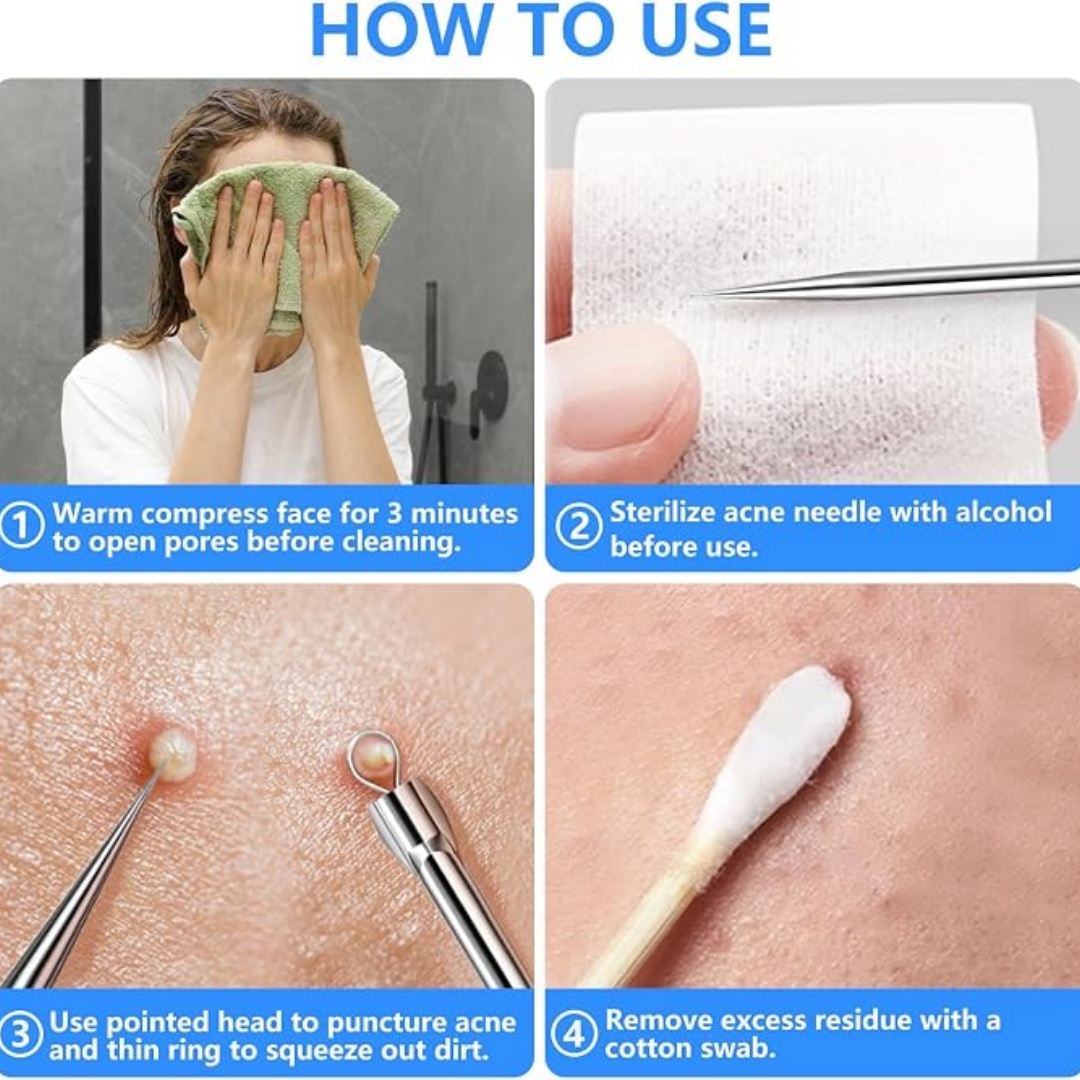 Набор из 5 предметов для удале – обзор и цена Luxury Skincare Acne